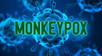 monkeypox stocks