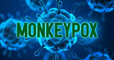 monkeypox stocks